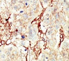 Fibroblast Growth Factor Receptor 3 Antibody (FGFR3)