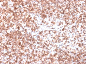 IHC testing of recombinant CD45 antibody and FFPE human lymph node (clone PTPRC/1975R). Required HIE