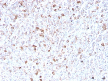 IHC staining of FFPE human spleen with recombinant Lambda antibody (clone LLC/3778R). HIER: boil tis