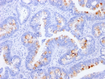 IHC staining of FFPE human colon with CEA antibody (clone C66/1291). HIER: boil tissue sections in p