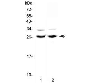 Western blot testing of 1) rat testis and 2) mouse ovary lysate with MAD antibody at 0.5ug/ml. Predi