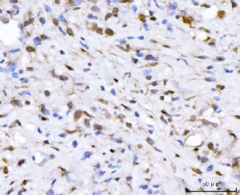 FGF2 Antibody / Fibroblast growth factor 2