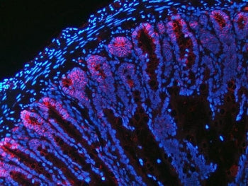 NKCC1 Antibody / SLC12A2