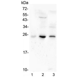 Western blot testing of human 1) placenta, 2) HL-60 and 3) Caco-2 lysate with Grancalcin antibody at