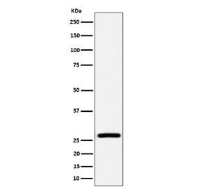 Western blot testing of human HepG2 cell lysate with Adenylate kinase 2 antibody. Predicted molecula
