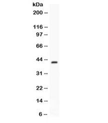 CFD Antibody / Complement Factor D