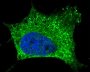 Fluorescent confocal image of SY5Y cells stained with NGFR antibody. Alexa Fluor 488 secondary Ab (g