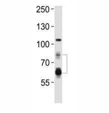 Western blot analysis of lysate from HeLa cell line using PCSK9 antibody. Predicted size: Pro/mature