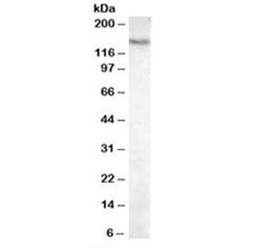 Western blot testing of mouse liver lysate with Pyruvate Carboxylase antibody at 0.03ug/ml. Predicte