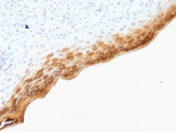Filaggrin Antibody