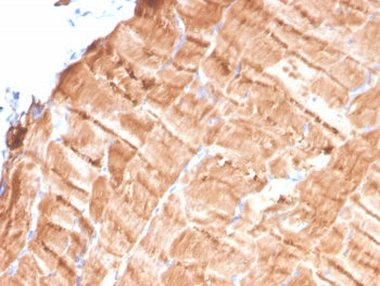 TPM1 Antibody / Tropomyosin-1 / Alpha Tropomyosin