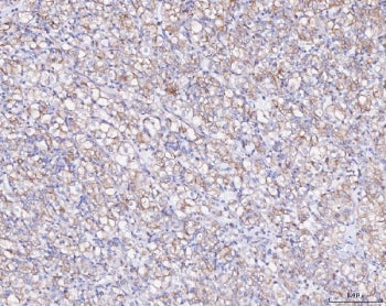 Ataxin-2 Antibody / ATXN2