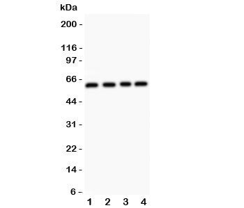 Western blot testing of RUNX2 antibody and Lane 1: HeLa; 2: A431; 3: K562; 4: Jurkat. Predicted mole