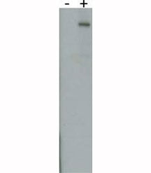 LRRK2 antibody detect over-expressed human LRRK2 protein.