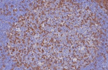 IHC staining of FFPE human tonsil tissue with CD3e antibody (clone C3e/8116R). HIER: boil tissue sec