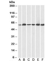 Western blot testing of human A) heart, B) kidney, C) liver lysates and pig D) heart, E) kidney, F) 