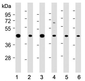 Western blot testing of human 1) A431, 2) MOLT4, 3) Jurkat, 4) PC-12, 5) mouse NIH3T3 and 6) mouse b