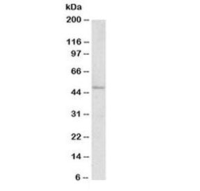 Western blot testing of human ovary lysate with FOXL2 antibody at 1ug/ml. Predicted molecular weight