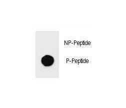 Dot blot analysis of phospho-c-Kit antibody. 50ng of phos-peptide or nonphos-peptide per dot were sp