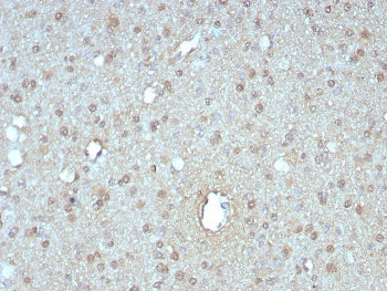 IHC staining of FFPE human pancreas tissue with GIRK2 antibody (clone KCNJ6/7558) at 2ug/ml. HIER: b
