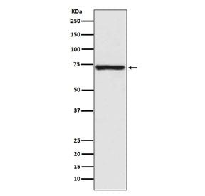 Western blot testing of human fetal kidney lysate with Calpain 1 antibody. Predicted molecular weigh