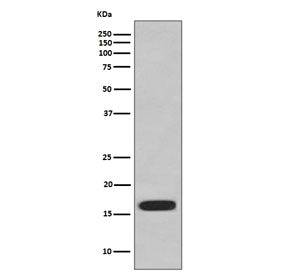 Western blot testing of HUVEC cell lysate with CD59 antibody. Expected molecular weight: 14-20 kDa d