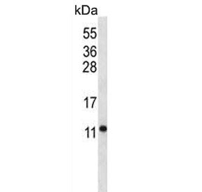 Western blot testing of mouse stomach tissue lysate with ATPase subunit F6 antibody. Predicted molec