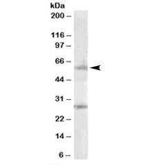 SOCS7 Antibody