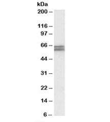 Western blot testing of human colorectal cancer lysate with CADM1 antibody at 1ug/ml. Predicted mole