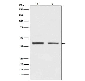 Western blot testing of human 1) HeLa and 2) HepG2 cell lysate with HNRNPC antibody. Expected molecu