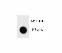 Dot blot analysis of phospho-c-Kit antibody. 50ng of phos-peptide or nonphos-peptide per dot were sp