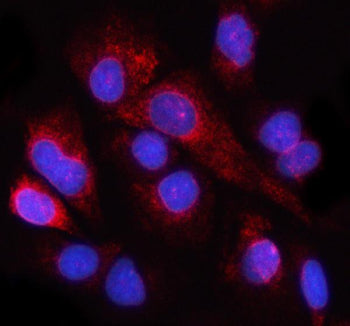 Immunofluorescent staining of NUP98 using anti-NUP98 antibody (red). NUP98 was detected in an immuno