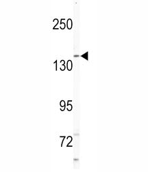 NIK Antibody (Nck-interacting kinase)