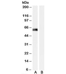 Western blot testing of human muscle lysate with SNTA1 antibody at 0.01ug/ml with [B] and without [A