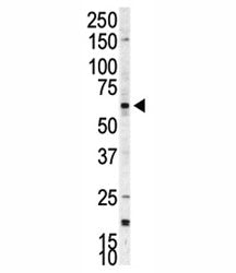 p70 S6 Kinase beta Antibody