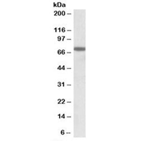 Western blot testing of K562 lysate with RACGAP1 antibody at 1ug/ml. Predicted molecular weight: ~71