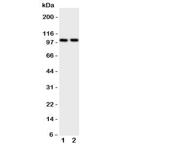 Western blot testing of ZO-3 antibody and Lane 1: rat brain; 2: rat heart tissue lysate. Predicted/o