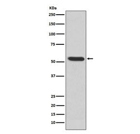 Western blot testing of human recombinant protein with MMP3 antibody. Predicted molecular weight ~54