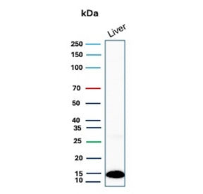 Western blot testing of human liver lysate with Transthyretin antibody. Predicted molecular weight ~