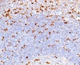IHC testing of human tonsil and CD68 antibody (CDLA68-1). HIER: staining of formalin/paraffin tissue