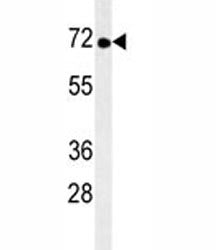 TNK1 Antibody, 0.08ml