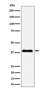 Western blot analysis of NSDHL expression in A431 cell lysate using NSDHL antibody. NSDHL is an ER-a