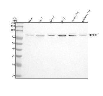 Western blot analysis of BDKRB2 using anti-BDKRB2 antibody. Lane 1: human Hela whole cell lysates, L