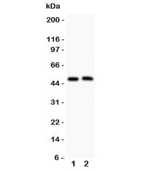 Western blot testing of Aquaporin 0 antibody and Lane 1: mouse spleen; 2: mouse intestine; Observed 