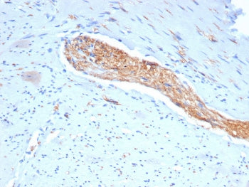 IHC staining of FFPE human colon tissue with CD56 antibody (clone NCAM/7522). HIER: boil tissue sect