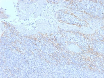 Beta Catenin Antibody