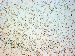 Tryptophan Hydroxylase 2 Antibody / TPH2