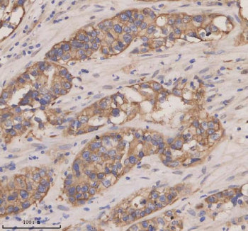 Immunohistochemical staining of CXCL13 using anti-CXCL13 antibody. CXCL13 was detected in a paraffin
