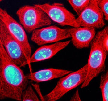 Immunofluorescent staining of TCOF1 using anti-TCOF1 antibody (green) and anti-Beta Tubulin antibody