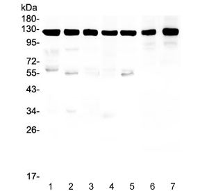 Western blot testing of human 1) HeLa, 2) U-87 MG, 3) T-47D, 4) A549, 5) U-2 OS, 6) rat brain and 7)